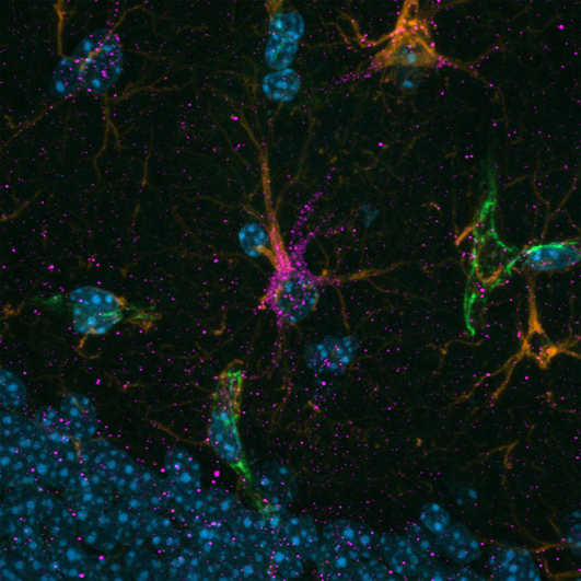 Estas neuronas del cerebro se benefician del ejercicio y ayudan a frenar el alzhéimer Estas neuronas del cerebro se benefician del ejercicio y ayudan a frenar el alzhéimer