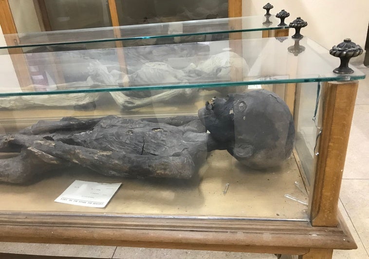 La Complutense halla en unas horas la momia perdida en el Museo Forense tras la denuncia de ABC La Complutense halla en unas horas la momia perdida en el Museo Forense tras la denuncia de ABC