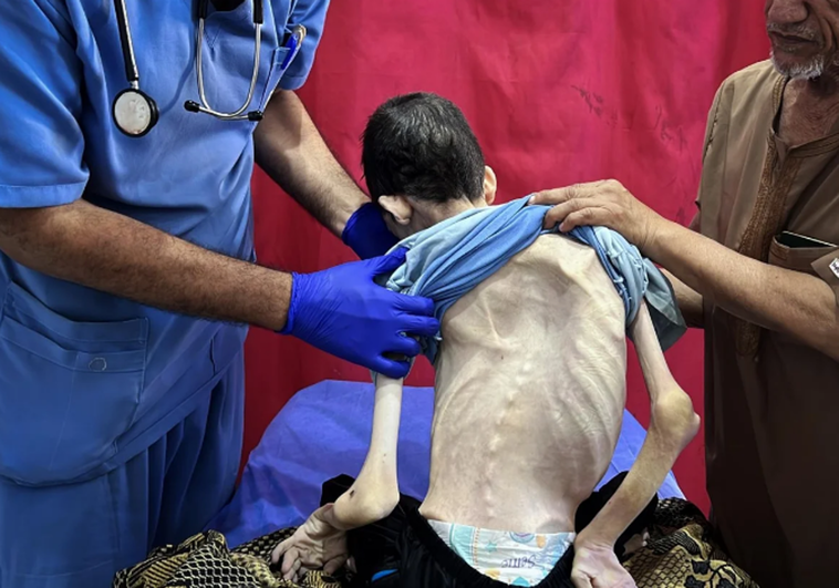 Contando calorías en el infierno: lo que contienen las polémicas cajas de ayuda en Gaza y por qué no resuelven la crisis Contando calorías en el infierno: lo que contienen las polémicas cajas de ayuda en Gaza y por qué no resuelven la crisis